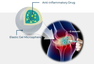 서방형 약물방출 관절염 치료 미립구 이미지